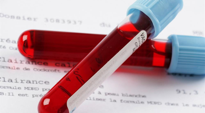 血液檢查應(yīng)注意5點(diǎn)以及紅細(xì)胞壽命測(cè)定介紹2