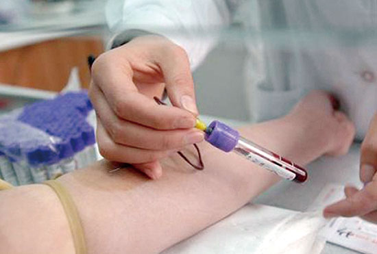 血液檢查應(yīng)注意5點(diǎn)以及紅細(xì)胞壽命測(cè)定介紹